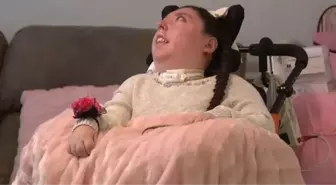 Beyinsiz doğan Alex Simpson kimdir? Alex Simpson kaç yaşında, nereli?