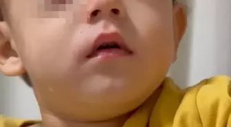 Çocukların Gözünü Kaybetmesine Neden Olan Torpil Fırından Alındı