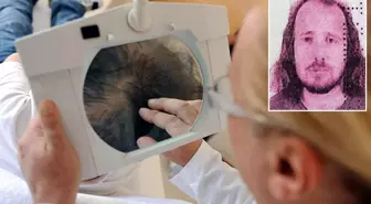 Saç ektirip diş yaptıran İngiliz aniden fenalaşarak hayatını kaybetti