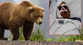 Neye uğradığını şaşırdı! Pençe darbeleri aldı, elmacık kemiği koptu