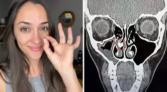 35 yıl sonra ortaya çıkan gerçek: Burnundan çıkan şeye kimse inanamadı