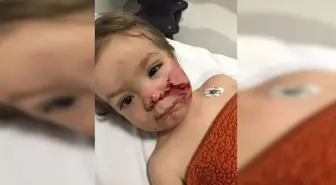 Pitbull Köpeği Saldırısında 2 Çocuk Yaralandı