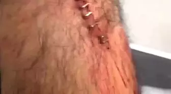 Şanlıurfa'da Öğretmene Jiletli Saldırı