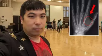 Akılalmaz hata! Eline yerleştirdiği mikroçipin şifresini unuttu