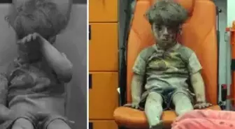 Bakın nerede ortaya çıktı: İşte dünya gündemine oturan Ümran bebeğin son hali