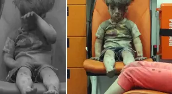 Bakın nerede ortaya çıktı: İşte dünya gündemine oturan Ümran bebeğin son hali