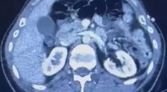 İranlı şüphelilerin midelerinde uyuşturucu tespit edildi; 3 gözaltı