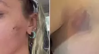 Yıldız Asyalı eşi Mustafa Semih Demirci'den şiddet mi gördü? Yıldız Asyalı kocasından şiddet mi gördü?