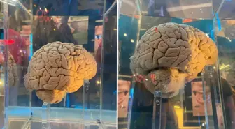 Amsterdam'daki dev arşiv: 5 bin 300 beyin yapay zeka ile haritalanacak