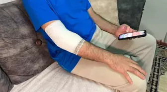 Başakşehir'de sitenin güvenlik görevlisine sahipli köpek saldırdı