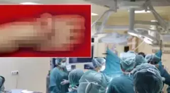 Eşi benzeri olmayan olay! Kulağını 5 ay ayağında taşıdı