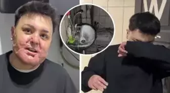 65 ameliyat geçirdi, 12 gün uyutuldu! Hayatı saniyeler içinde kabusa döndü