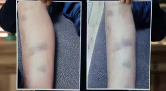 Diyarbakır'da özel okulda 8 yaşındaki çocuğun darbedildiği iddiası