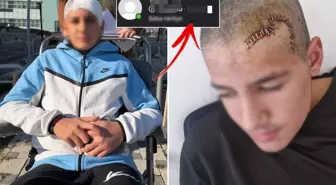 Okul arkadaşı taşla kafasını parçaladı! Tahliye edilen çocuğun paylaşımı çıldırttı