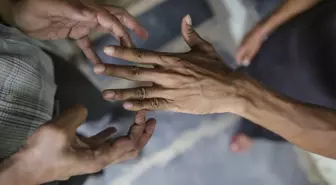 44 yıl sonra bir ilk! 2 ülkede cüzzam vakaları görülmeye başladı