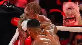 6. rauntta kabusu yaşamıştı! İşte çenesi kırılan Jake Paul'un son hali
