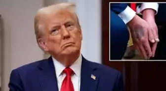 Trump elindeki morlukların nedenini ilk kez açıkladı