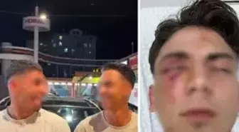 Muştalarla döverek kör ettiler, ellerinde kan ile video çektiler! 1,5 ayda tahliye olan şüpheliler yeniden gözaltında