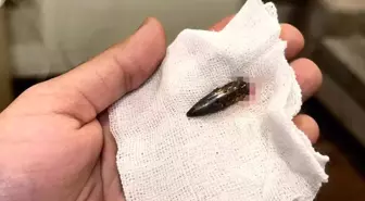 Gazzeli Awad, 1,5 yıldır kafasında taşıdığı mermiden Türk yardımseverlerin desteğiyle kurtuldu