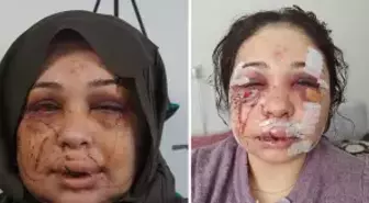 Polis eşi tarafından darbedildiği iddiasıyla şikayetçi oldu