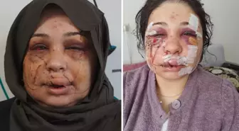 Polis eşi tarafından darbedildiği iddiasıyla şikayetçi oldu