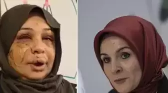 Bakan Göktaş: Şiddete uğrayan kardeşimizin yanındayız, davaya müdahil olacağız