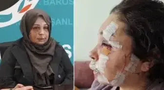 Eşini bu hale getiren Cumhurbaşkanı Koruma Dairesi personeli tutuklandı