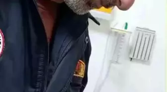 Sıkışan yüzük itfaiye ekiplerince çıkarıldı