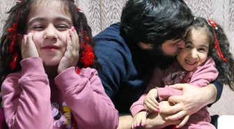 Yapışık parmakla doğan Elif'in tedavisi babasının işten çıkarılmasıyla yarım kaldı
