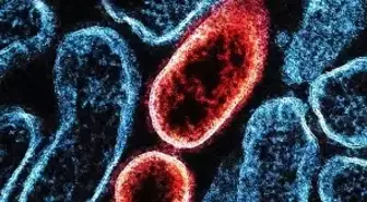 Nipah virüsü nedir, nasıl yayılıyor, ne kadar tehlikeli?