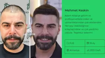 En İyi Saç Ekimi Merkezi Nasıl Seçilir? Adem Köse ile Doğal Sonuçların Peşinde