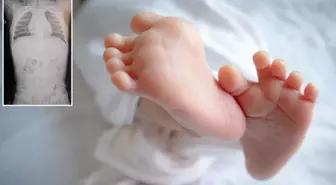 1 yaşındaki bebek sırtüstü yatırılınca hep ağladı! Gerçeği öğrenen aile şoke oldu