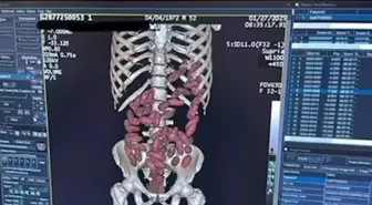 2025'te İstanbul Havalimanı'nda 'yutucu' kuryelerden 29,7 kilo uyuşturucu ele geçirildi