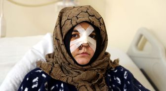Eşinin kaldırım taşı ile dövdüğü Nazlı: Çıkarsa yarım bıraktığı işi tamamlar