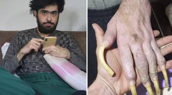 Türkiye'nin konuştuğu Barış'ın yeni işini ve son halini görenler şaşıp kalıyor