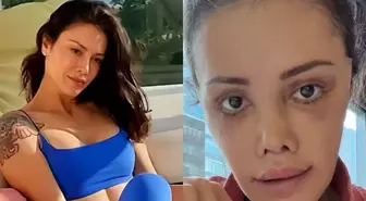 Yüz nakli yaptıran Didem Ceran'ın son hali: Harika gözüküyorum