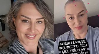 Şıvga Gerez ne kanseri? Şıvga Gerez'in hastalığı ne, neden vefat etti?
