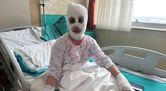 İftara hazırlık sırasında patlayan düdüklü tencere iki çocuk annesini hastanelik etti