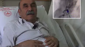 Göğüs yanması şikayetiyle gittiği hastanede kalbinden kan 'çalan' damar bulundu