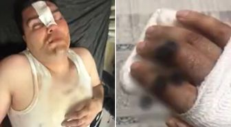 Hesabı ortak ödediler, dayağı tek başına yedi! Her şey 13 binlik 'çerez' ile başladı