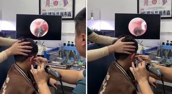 Küçük çocuğun kulağından çıkana, doktorlar bile şaştı kaldı