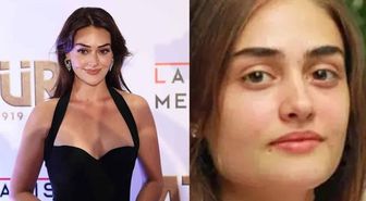 Esra Bilgiç estetik yaptırdı mı? Esra Bilgiç kimdir, kaç yaşında, nereli?