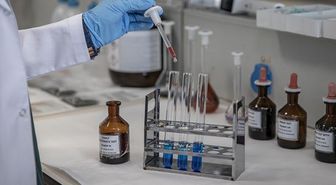 İşe girişte uyuşturucu testi zorunlu mu oldu? İşe alımda madde testi şart mı? Uyuşturucu test fiyatı ne kadar?