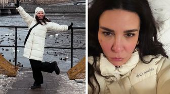 Ünlü şarkıcı Fatma Turgut'un yüzü soğuktan bu hale geldi