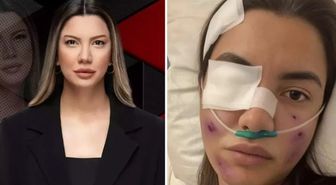 Fulya Öztürk trafik kazası mı geçirdi, görüntüler yapay zeka ile mi yapıldı? Fulya Öztürk ne açıklama yaptı?
