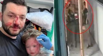 Yalova'da baba ile 14 aylık bebeğinin darbedildiği görüntüler: Yalova'daki olayın görüntüleri yayınlandı mı?