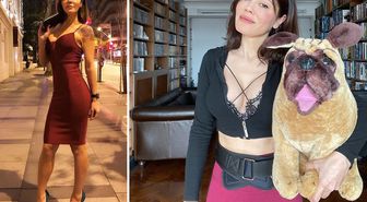 Yüz nakli yaptıran Didem Ceran, günler sonra son halini paylaştı