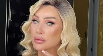 Seda Sayan estetik mi yaptırdı, yüzünde kaç tane estetik var? Seda Sayan yüzüne ne yaptırdı, kaç tane estetik operasyonu geçirdi?