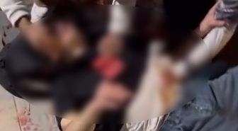 Ankara'da metro istasyonu çıkışında bıçaklı kavga: 2 yaralı