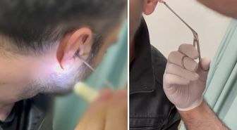 Kulağına gizlediği uyuşturucuyla yakalandı